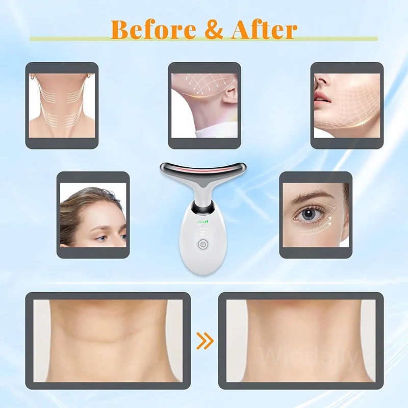 π 7-Color Face & Neck Lifting Beauty DeviceπΈ Tighten, Brighten & Rejuvenate Your Skin with Smart LED Therapy - Image 3